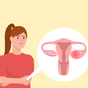 다낭성난소증후군, 그냥 지나치면 안되는 이유