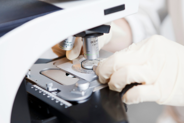 자궁경부이형성증_진단