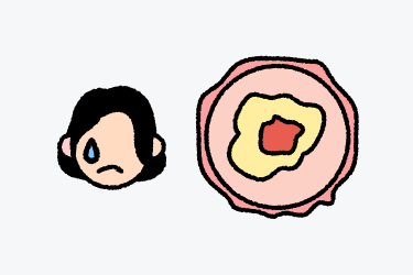 자궁경부이형성증이란?