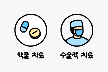 난소낭종, 치료 방법